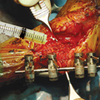 ortho4